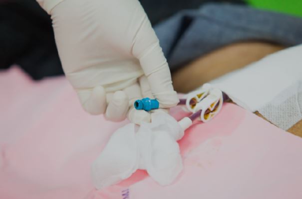Permacath Insertion